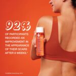 Bio-Oil Skincare Oil | Specialist Skincare Formulation | 200ml